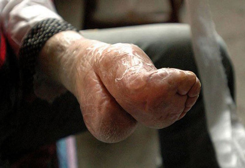 Пальцы Ног Женщин Фото